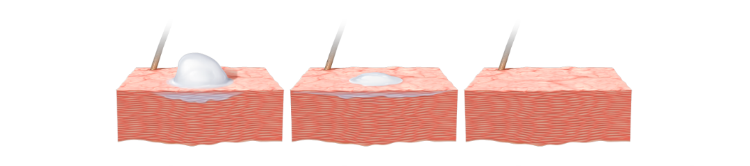 CeraVe